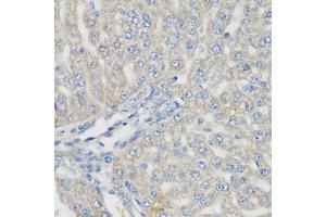 Immunohistochemistry of paraffin-embedded rat liver using METTL7A antibody. (METTL7A 抗体  (AA 30-244))