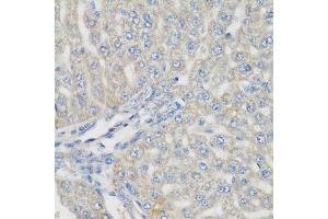 Immunohistochemistry of paraffin-embedded rat liver using METTL7A antibody.