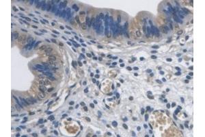 Immunohistochemistry (IHC) image for anti-Prenylcysteine Oxidase 1 (PCYOX1) (AA 249-505) antibody (ABIN7441472)