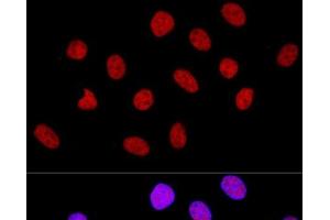Confocal immunofluorescence analysis of U-2 OS cells using CTCF Polyclonal Antibody at dilution of 1:100. (CTCF 抗体)