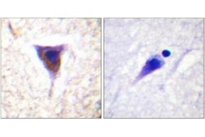 Immunohistochemistry analysis of paraffin-embedded human brain, using mTOR (Phospho-Ser2481) Antibody. (MTOR 抗体  (pSer2481))