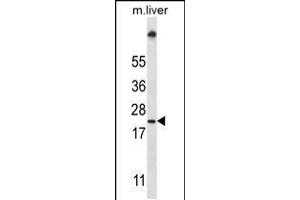 Western blot analysis in mouse liver tissue lysates (35ug/lane). (UBE2W 抗体  (C-Term))