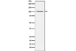 Western blot analysis of Gemin 3 expression in 293T cell lysate.