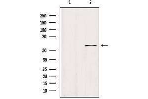 Western blot analysis of extracts from 293, using ALDH1A3 Antibody. (ALDH1A3 抗体  (Internal Region))