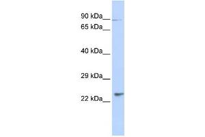 Western Blotting (WB) image for anti-Leucine Rich Transmembrane and 0-Methyltransferase Domain Containing (LRTOMT) antibody (ABIN2459913) (Leucine Rich Transmembrane and 0-Methyltransferase Domain Containing (LRTOMT) 抗体)