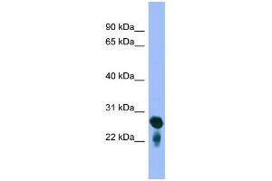 WB Suggested Anti-RAB5C Antibody Titration: 0. (Rab5c 抗体  (Middle Region))
