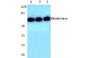 Western blot (WB) analysis of Clusterin-α antibody at 1/500 dilution (Clusterin 抗体)