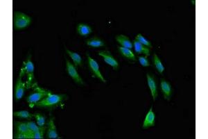 Immunofluorescent analysis of Hela cells using ABIN7171209 at dilution of 1:100 and Alexa Fluor 488-congugated AffiniPure Goat Anti-Rabbit IgG(H+L) (SNCAIP 抗体  (AA 309-553))