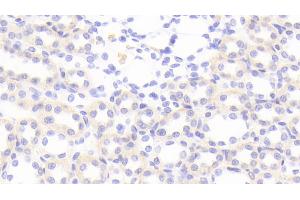 Detection of MIg in Rat Kidney Tissue using Polyclonal Antibody to Monokine Induced By Interferon Gamma (MIg) (CXCL9 抗体  (AA 22-125))