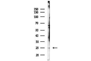 Western blot analysis of lysates from Hela cells(heat-shock,45 min treatment), using OR2 Antibody at 1/1000 dilution.