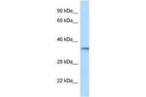 WB Suggested Anti-RGD1310788 Antibody Titration: 1. (HVCN1 抗体  (C-Term))