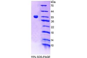 SDS-PAGE analysis of Human TESK1 Protein. (TSSK1 蛋白)