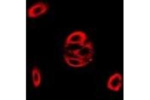 Immunofluorescent analysis of Fis1 staining in MCF7 cells. (Fission 1 抗体)