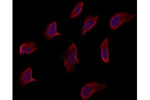 ABIN6262960 and ABIN6273263 staining Hela by IF/ICC. (EIF2D 抗体  (Internal Region))
