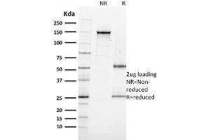 SDS-PAGE (SDS) image for anti-Antigen Identified By Monoclonal Antibody Ki-67 (MKI67) (AA 2293-2478) antibody (ABIN6940053)