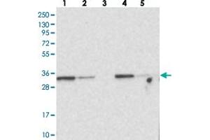 Western blot analysis of Lane 1: RT-4, Lane 2: U-251 MG, Lane 3: Human Plasma, Lane 4: Liver, Lane 5: Tonsil with MTCH2 polyclonal antibody .