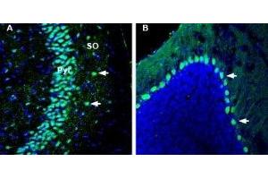 Expression of Kidins220 in mouse hippocampus and cerebellum - Immunohistochemical staining of perfusion-fixed frozen mouse brain sections with Anti-Kidins220 Antibody (ABIN7043293, ABIN7045160 and ABIN7045161), (1:1000), followed by goat-anti-rabbit-AlexaFluor-488. (KIDINS220 抗体  (Intracellular))
