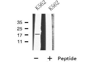 Western blot analysis of MRPL23 using K562 whole cell lysates (MRPL23 抗体  (Internal Region))