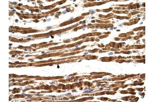 NARG1L antibody was used for immunohistochemistry at a concentration of 4-8 ug/ml to stain Skeletal muscle cells (arrows) in Human Muscle.