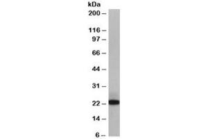 Western blot testing of Jurkat lysate with MAX antibody at 0. (MAX 抗体)