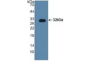 Detection of Recombinant CTBP2, Human using Polyclonal Antibody to C-Terminal Binding Protein 2 (CTBP2) (CTBP2 抗体  (AA 1-252))