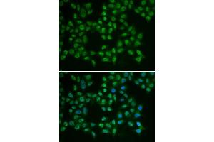 Immunofluorescence (IF) image for anti-Bruton Agammaglobulinemia tyrosine Kinase (BTK) (AA 30-240) antibody (ABIN6218643) (BTK 抗体  (AA 30-240))