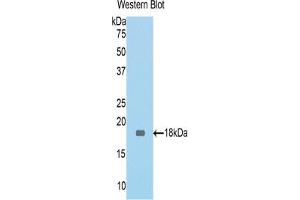 Western blot analysis of the recombinant protein. (MGEA5 抗体  (AA 83-222))