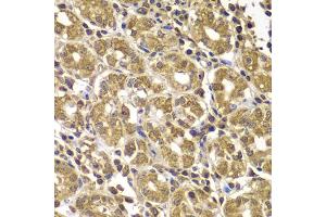 Immunohistochemistry of paraffin-embedded human gastric using HSPE1 antibody (ABIN5975532) at dilution of 1/100 (40x lens). (HSPE1 抗体)