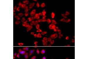 Immunofluorescence analysis of A549 cells using EIF4G1 Polyclonal Antibody (EIF4G1 抗体)