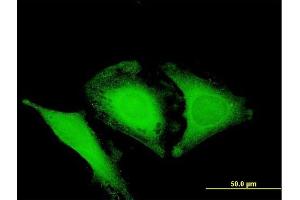 Immunofluorescence of purified MaxPab antibody to OPTN on HeLa cell.
