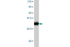 Western Blotting (WB) image for anti-Aspartyl-tRNA Synthetase (DARS) (AA 393-500) antibody (ABIN560561)