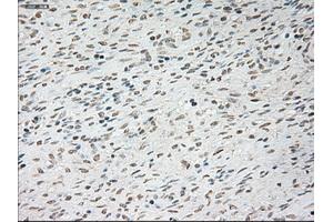Immunohistochemical staining of paraffin-embedded Ovary tissue using anti-TNNI3mouse monoclonal antibody. (TNNI3 抗体  (AA 1-210))