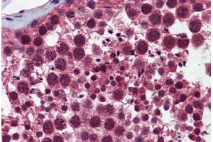 Human Testis: Formalin-Fixed, Paraffin-Embedded (FFPE) (Selenoprotein S 抗体  (AA 72-121))