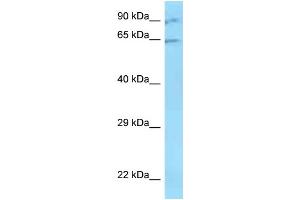 WB Suggested Anti-ZNF280B Antibody   Titration: 1. (ZNF280B 抗体  (N-Term))