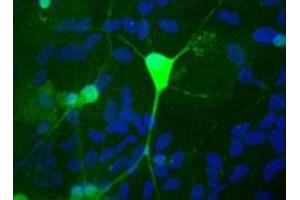 Shows rat mixed neuron/glial cultures stained with UCHL1 polyclonal antibody  (green). (UCHL1 抗体)
