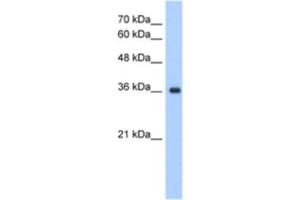 Western Blotting (WB) image for anti-ELOVL Fatty Acid Elongase 7 (ELOVL7) antibody (ABIN2463300)