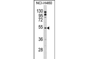 Western blot analysis of BLNK Antibody (Center) (ABIN390395 and ABIN2840787) in NCI- cell line lysates (35 μg/lane). (B-Cell Linker 抗体  (AA 150-178))