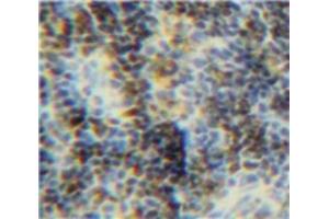 IHC-P analysis of Spleen tissue, with DAB staining. (BID 抗体  (AA 1-195))