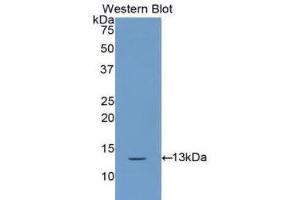 Western Blotting (WB) image for anti-Cystatin A (Stefin A) (CSTA) (AA 1-98) antibody (ABIN1172941) (CSTA 抗体  (AA 1-98))