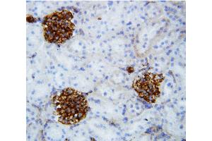 Immunohistochemistry (IHC) image for anti-Collagen, Type IV, alpha 2 (COL4A2) (AA 1697-1712), (C-Term) antibody (ABIN3042317)