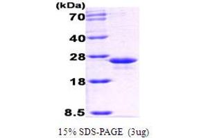 GrpE (AA 1-197), (V44I) protein