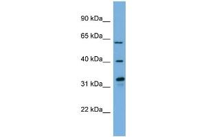 WB Suggested Anti-FMO3  Antibody Titration: 0. (FMO3 抗体  (N-Term))