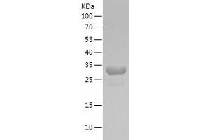 Western Blotting (WB) image for phosphoglycerate Mutase 1 (Brain) (PGAM1) (AA 79-154) protein (His-IF2DI Tag) (ABIN7282453) (PGAM1 Protein (AA 79-154) (His-IF2DI Tag))