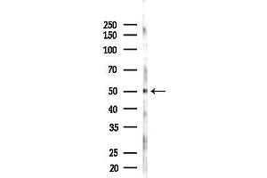 Western blot analysis of lysates from HepG2 cells(heat-shock,45 min treatment), using LUC7L3 Antibody at 1/1000 dilution.