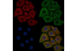 ABIN6259389 and ABIN6276155 staining Hela cells by IF/ICC.