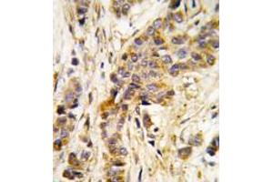 Image no. 1 for anti-Isoleucyl-tRNA Synthetase 2, Mitochondrial (IARS2) (Middle Region) antibody (ABIN360191) (IARS2 抗体  (Middle Region))