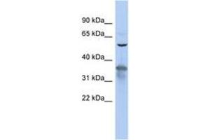 Image no. 1 for anti-RAB3A Interacting Protein (Rabin3) (RAB3IP) (AA 35-84) antibody (ABIN6743738) (RAB3IP 抗体  (AA 35-84))