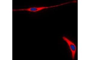 Immunofluorescent analysis of RET staining in HeLa cells. (Ret Proto-Oncogene 抗体  (C-Term))