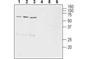 Western Blotting (WB) image for anti-Solute Carrier Family 18 (Vesicular Monoamine Transporter), Member 2 (SLC18A2) (AA 52-64) antibody (ABIN7043688)