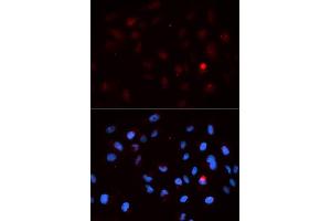 Immunofluorescence analysis of MCF-7 cells using Phospho-CDK1-T14 antibody. (CDK1 抗体  (pThr14))